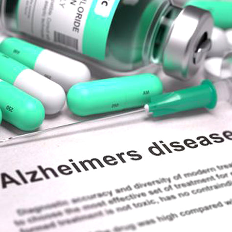 Alzheimer’s Disease: What Is the Best Treatment?